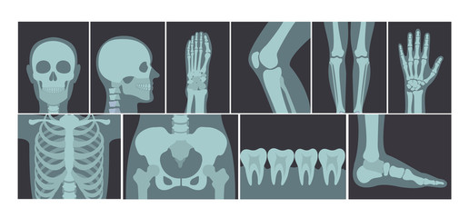 X Ray at Urgent Care Mt.Vernon