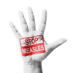 Measles Q&A: Everything You Need to Know