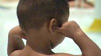 Swimmer's Ear or Middle Ear Infection: How to Know the Difference