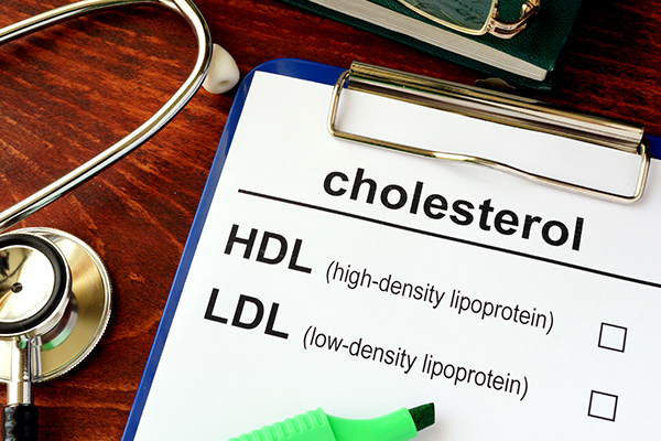 What Does Cholesterol Have to Do With Heart Health?