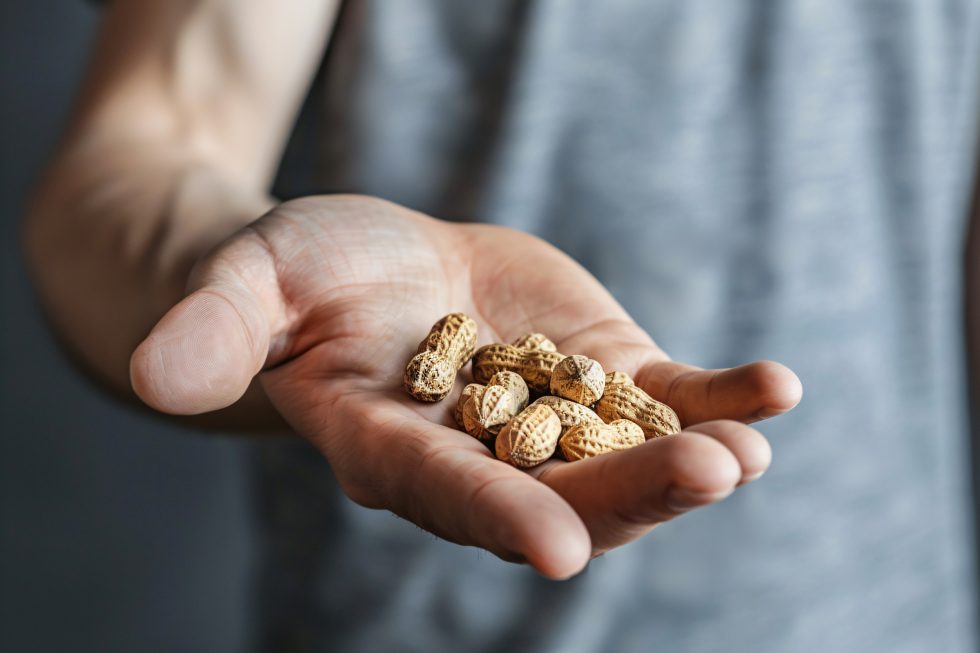 Why Has There Been a Rise in Peanut Allergies?