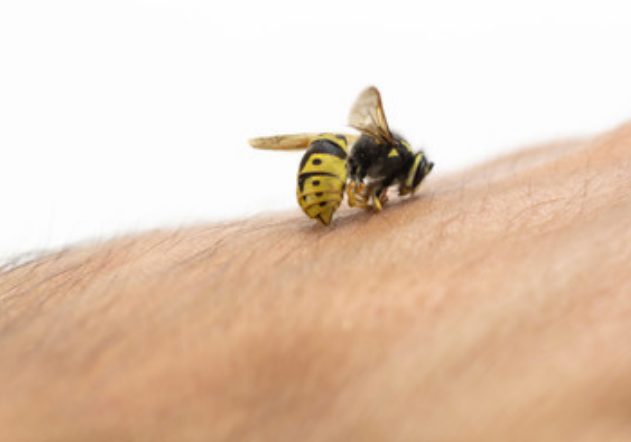 Person getting stung by a bee and having an allergic reaction